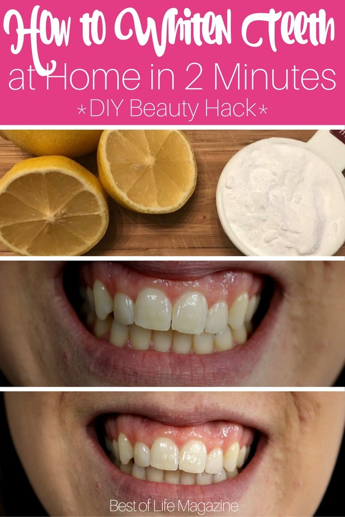 How to Whiten Teeth at Home in 2 Minutes