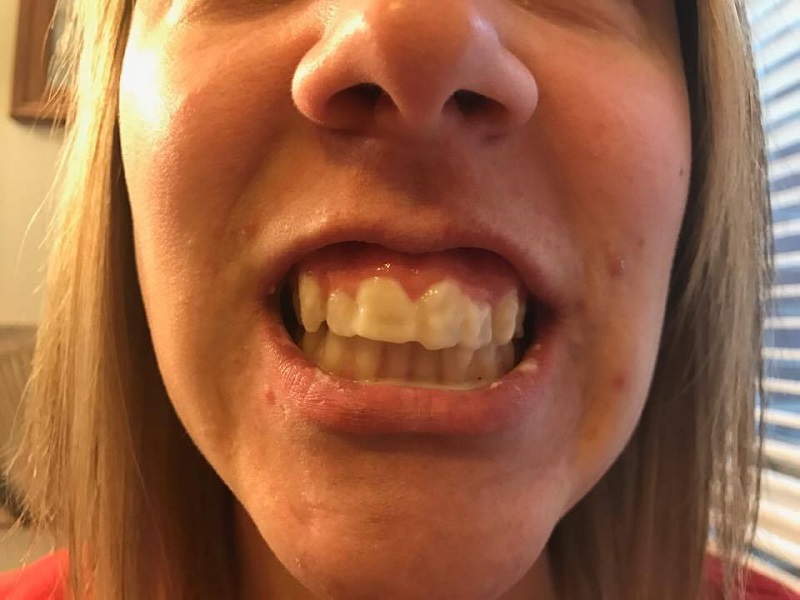 It can be tricky to figure out what works or how to whiten your teeth but this method is simple, just 2 ingredients! Instant results after just 2 minutes! How to Whitten Teeth | How to Get White Teeth | How to Properly Brush Your Teeth | How to Get a Better Smile 