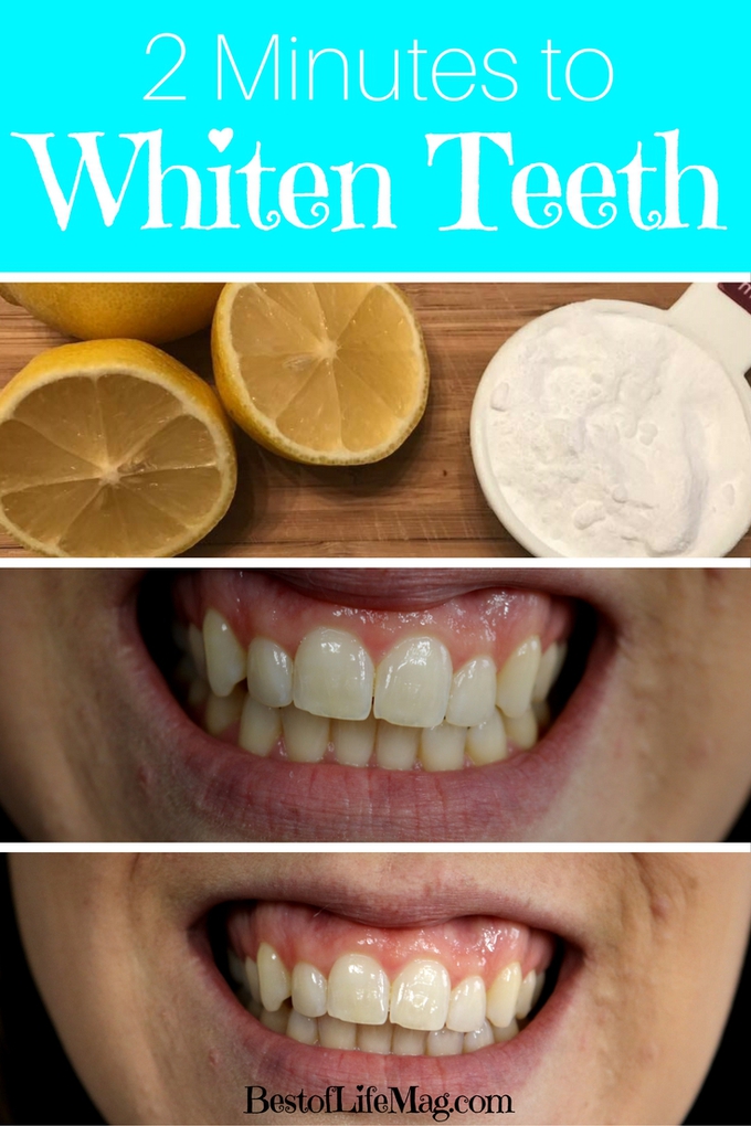 It can be tricky to figure out what works or how to whiten your teeth but this method is simple, just 2 ingredients! Instant results after just 2 minutes! Smile Tips | Tips for a Better Smile | DIY Teeth Whitener | At-Home Teeth Whitener | Beauty Tips | Health Tips #beauty #smile via @amybarseghian